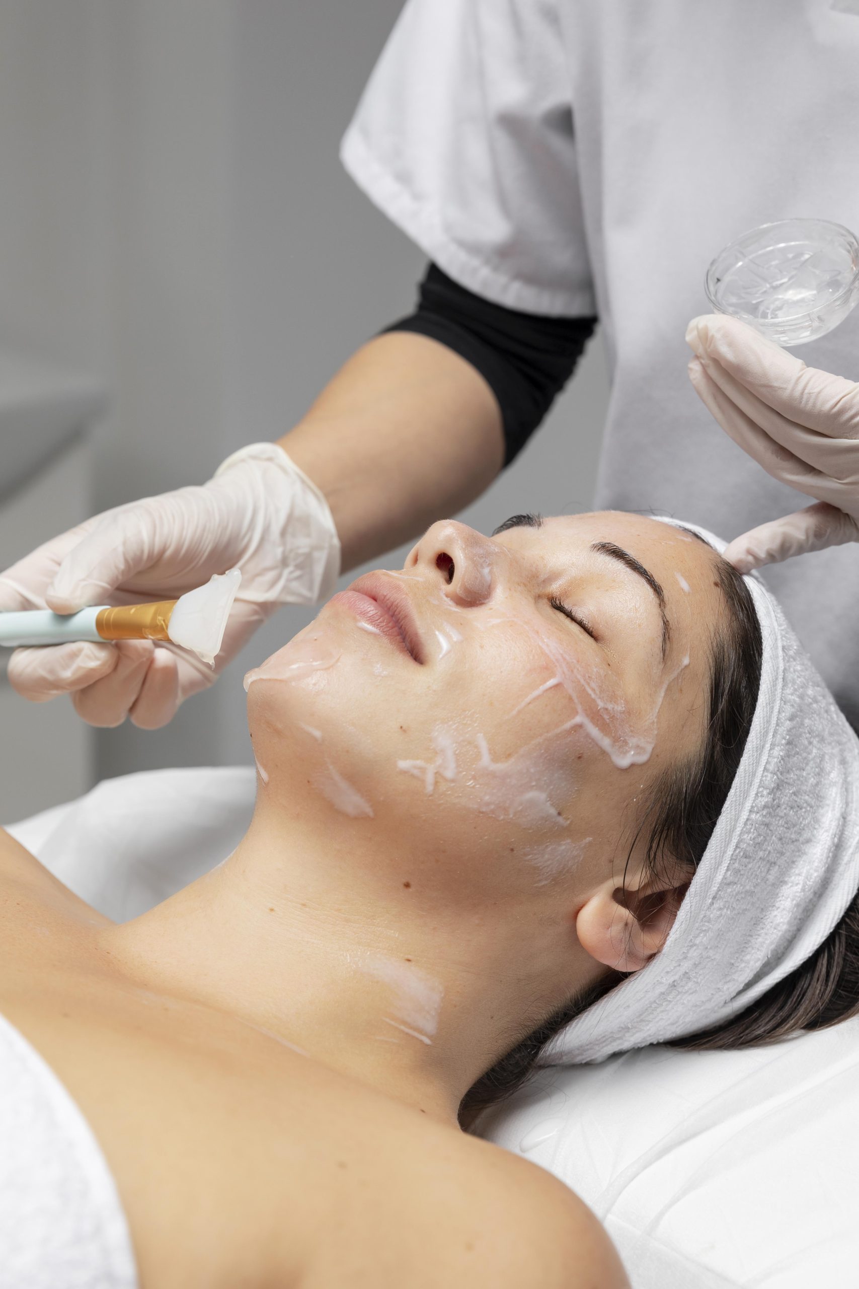 Benefits of Chemical Peels: What You Need to Know